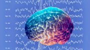 brain-during-epileptic-seizure