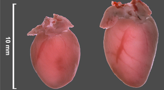 cardiac-hypertrophy-mice