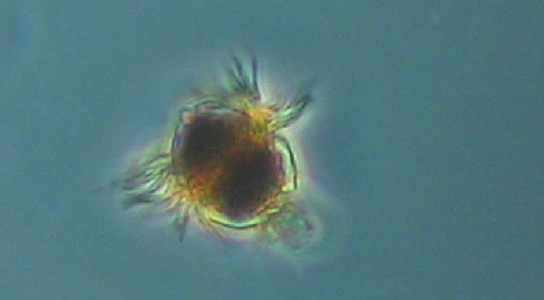 ciliate-mesodinium-protozoan