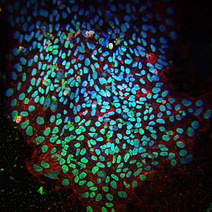 colony of induced pluripotent stem cells