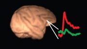 consciousness is not localised in a unique cortical area