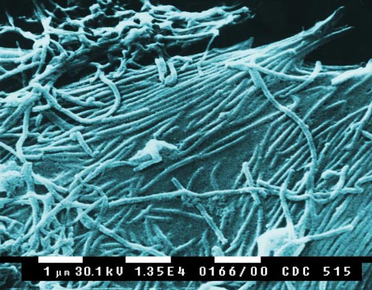ebola-virus-cdc