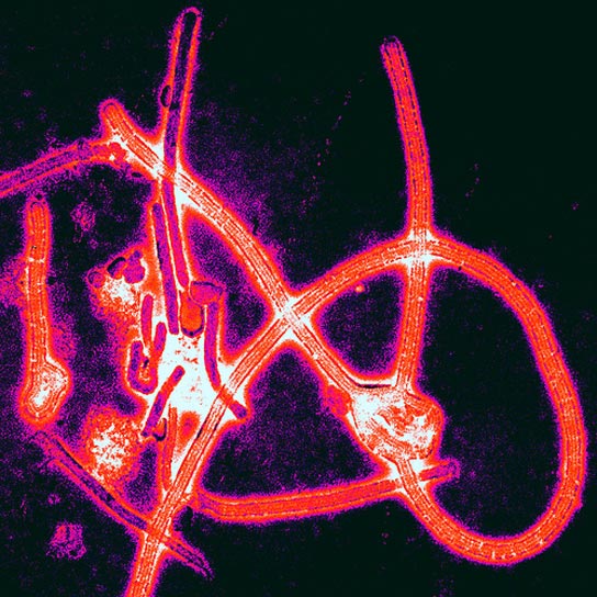ebola-virus-in-action