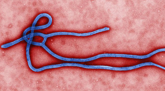 ebola-virus-virion-microscope