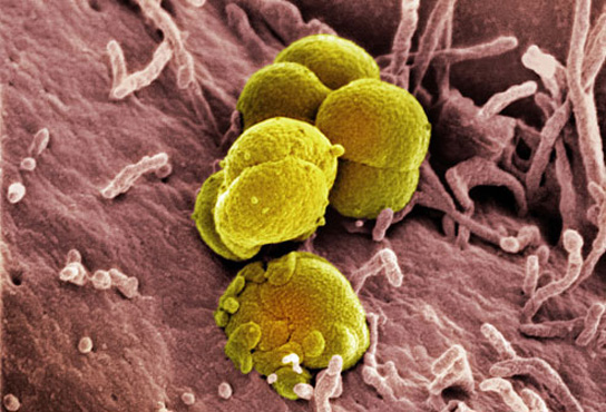 electron-micrograph-Neisseria-gonorrhoeae