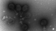 A transmission electron micrographs of prochlorococcus virus