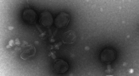 electron micrographs of prochlorococcus virus