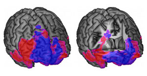 examining the frontal lobes