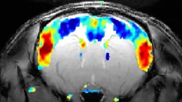 New Research Shows Individual Brain Activity Is As Unique As Fingerprints