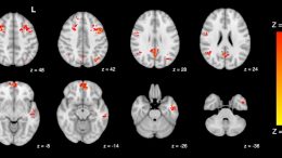 fMRI Shows Decreased Functional Connectivity in the Brain Following Exposure to Traffic Pollution