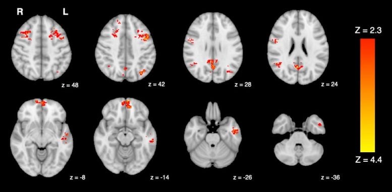 fMRI Shows Decreased Functional Connectivity in the Brain Following Exposure to Traffic Pollution