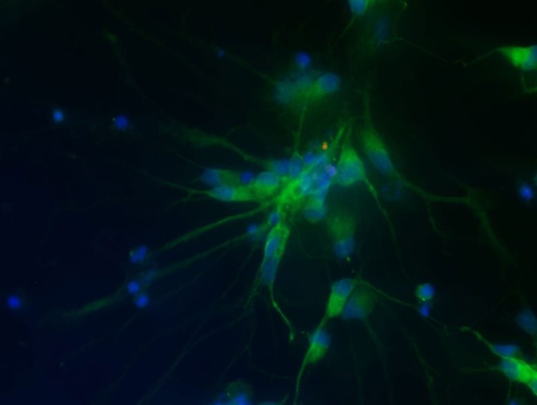 iPSC Derived Motor Neurons Carrying an ALS Linked Mutation