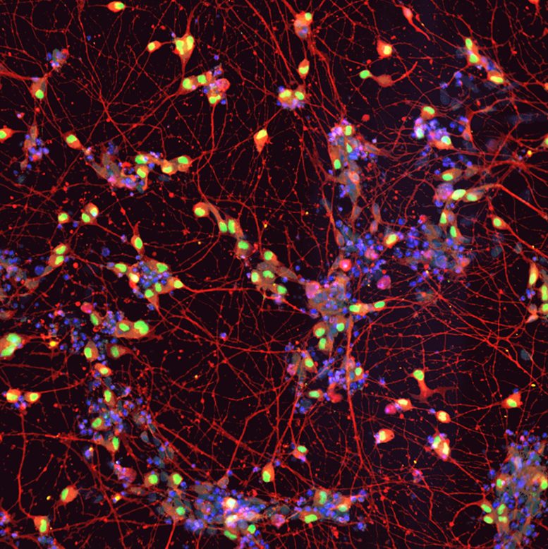 iPSCs Derived Motor Neurons Derived From an ALS Patient