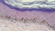 magnification of the four distinct strata of human skin