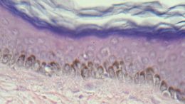 magnification of the four distinct strata of human skin