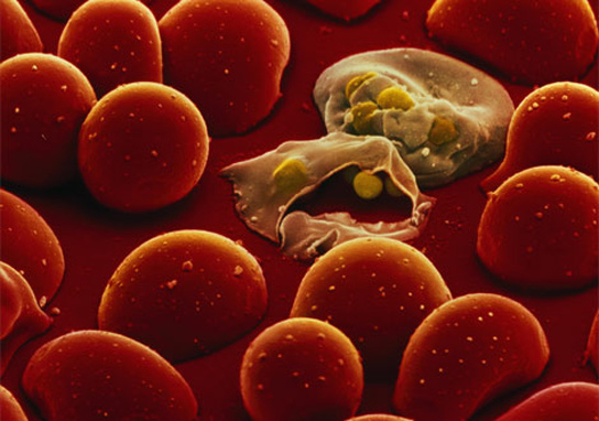 malaria-parasite