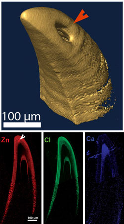 micro-computertomographic image of a fang tip