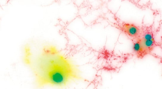 microglia-in-brain
