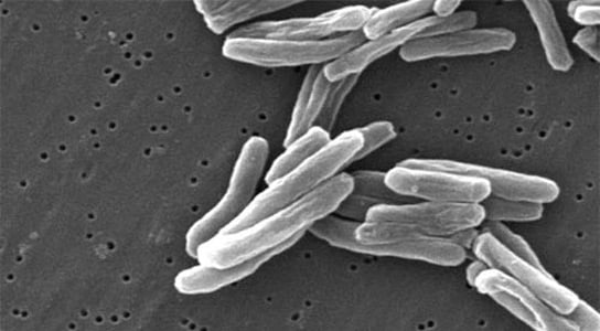 multi-drug-resistant-tuberculosis