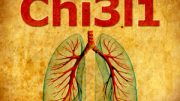 protein Chi3l1 role in regulating the immune response to pneumonia