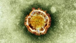 sars-coronavirus-virion