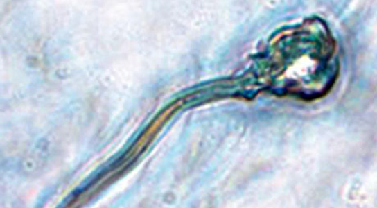 sperm-microscope-image