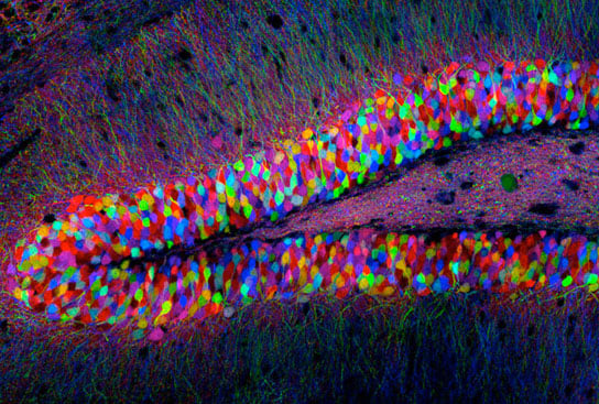 transgenic mouse hippocampus